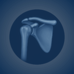 Shoulder Surgery Library